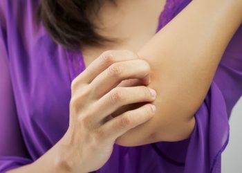 Sivrisinek Kaşıntısından Nasıl Kurtulabiliriz?