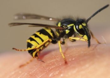 Arı Sokmalarında Yapılması Gerekenler Nelerdir?